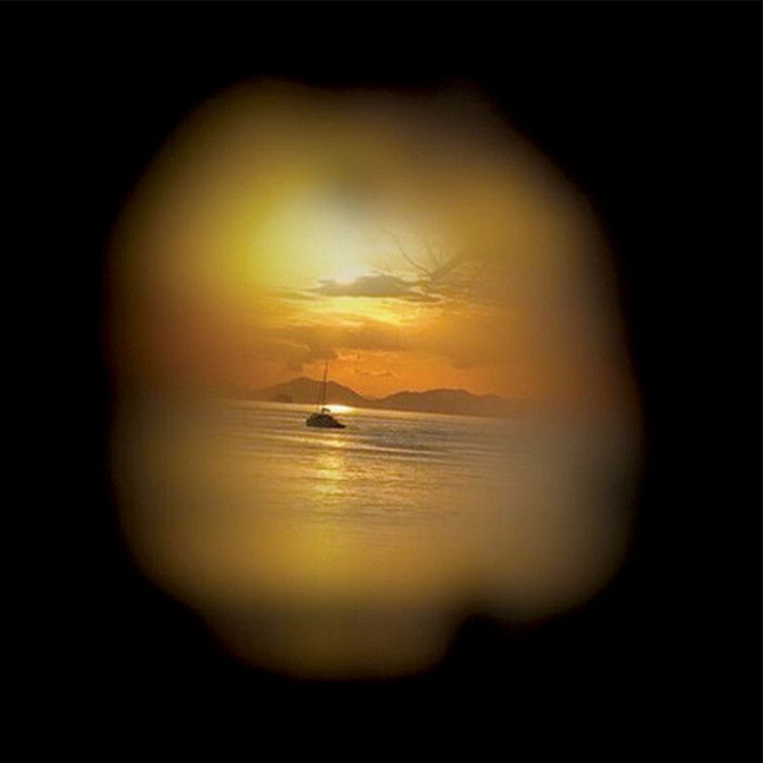 What is Myopia?